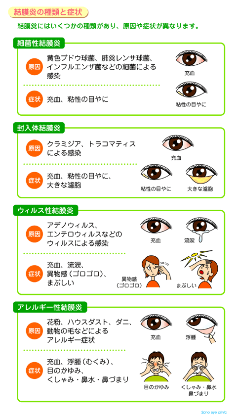 くしゃみ 眩しい 25%が太陽を見るとくしゃみが出る？実はアレルギーじゃなく運命！