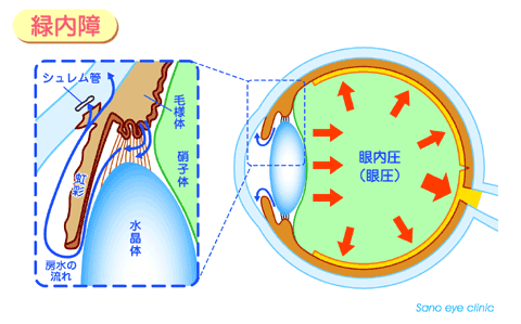 圧 と 眼 どうなる 高い が