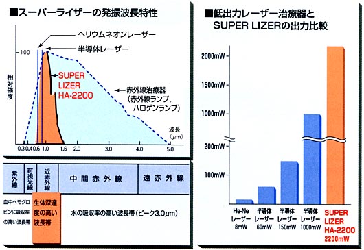 スーパーライザーの特性